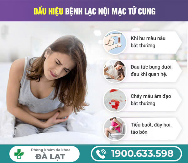 Hình ảnh minh họa